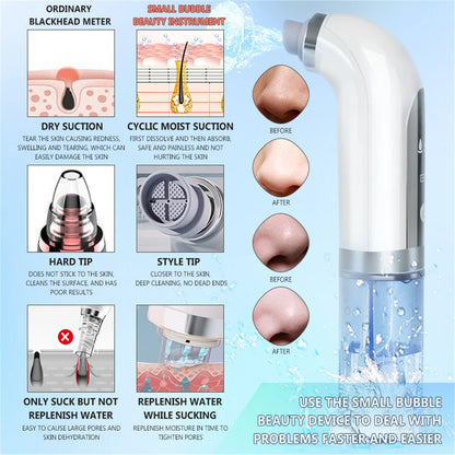 Electric Vacuum Face Cleaner Facial Blackhead Suction Remover Black Spot Pimple Removal Face Pore Cleaning Device for Skin Care