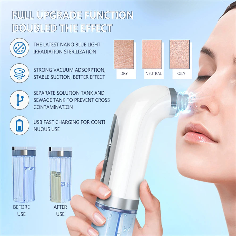 Electric Vacuum Face Cleaner Facial Blackhead Suction Remover Black Spot Pimple Removal Face Pore Cleaning Device for Skin Care