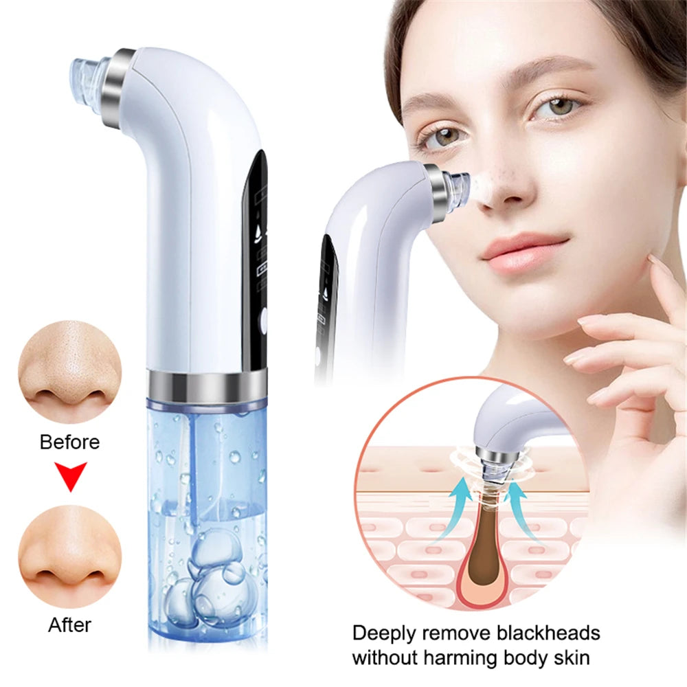 Electric Vacuum Face Cleaner Facial Blackhead Suction Remover Black Spot Pimple Removal Face Pore Cleaning Device for Skin Care