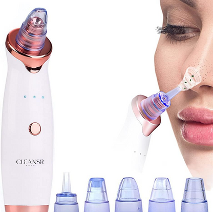 Pore Vacuum - blackhead & acne remover