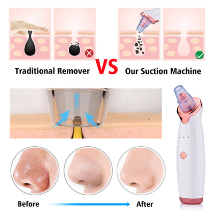 Electric Facial Blackhead Remover Vacuum Pore Cleaner Acne Cleanser Black Spots Removal Face Nose Deep Cleaning Tools